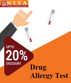 Drug Allergy Test